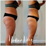 Ansicht von der Seite im Verlauf eines individuell begleiteten Abnehmprogramms