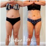 Vorderansicht im Verlauf eines ganzheitlichen Abnehmprogramms